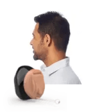 Microcanal (CIC)